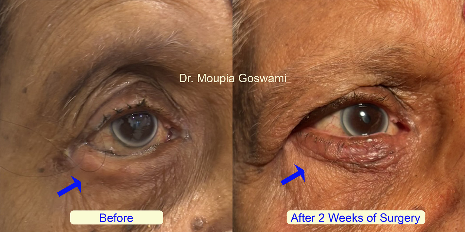 Before and After Comparison